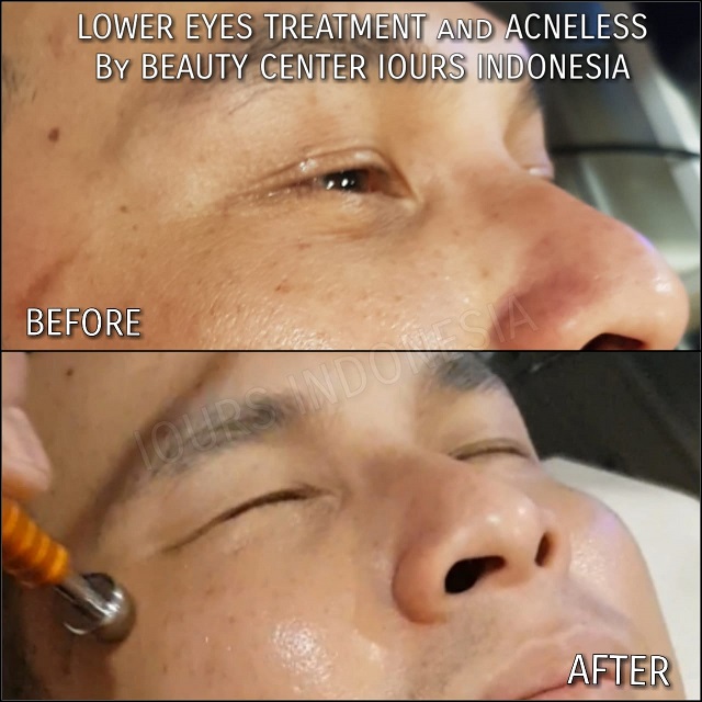 Beauty Treatment